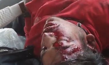 डिवाइडर से टकराई बाइक युवक गम्भीर घायल इंदौर रेफर